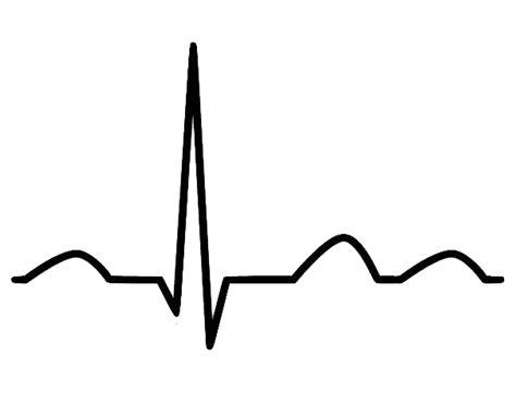 EKG Rhythm Strip Clip Art