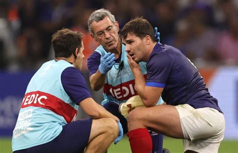 Antoine Dupont injury confirmed but Rugby World Cup hopes still alive ...