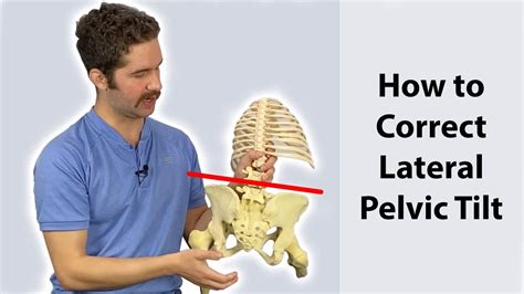 Lateral Pelvic Tilt Correction (4 step guide) - Works FAST! - YouTube