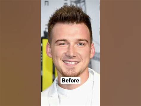 Morgan Wallen before and after fame Pt 2 #countrymusic #shorts #morganwallen #countryconcert ...