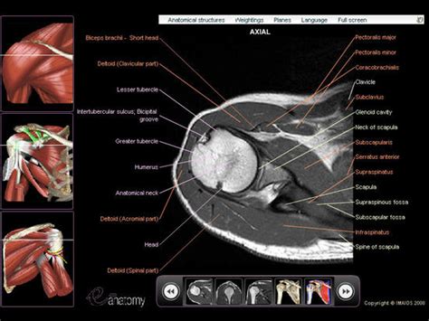 Shoulder: MRI, radiographical, and illustrated anatomical atlas