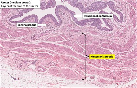 Ureter – Normal Histology – NUS Pathweb :: NUS Pathweb