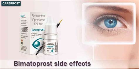 Bimatoprost Side Effects - Careprost.co