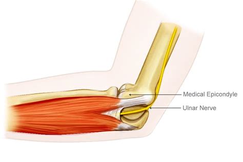 Elbow Shock: Why Do We Feel Electric Shock In Elbow While Banging?