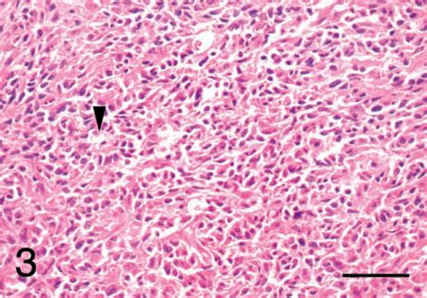 Immunohistochemical and Histopathologic Features of 14 Malignant ...