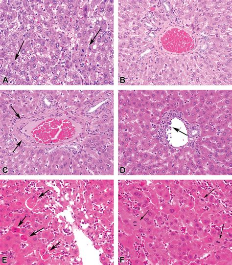 -Histopathological findings in the liver. (A) Anisokaryosis and mitoses... | Download Scientific ...