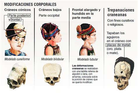 Paracas Elongated Skulls