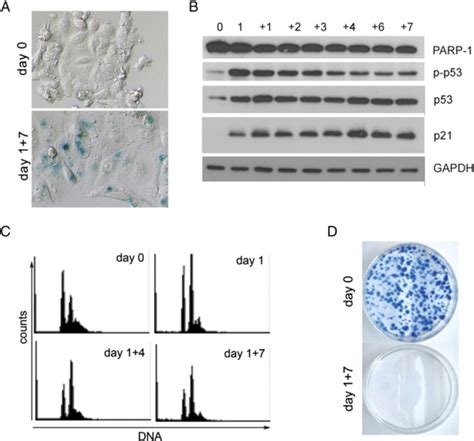 Markers of senescence of dox-treated MCF-7 cells. (A) SA-β-Gal–positive... | Download Scientific ...