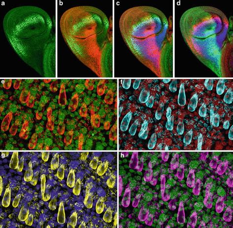 Laser Scanning Confocal Microscopy: History, Applications, and Related ...