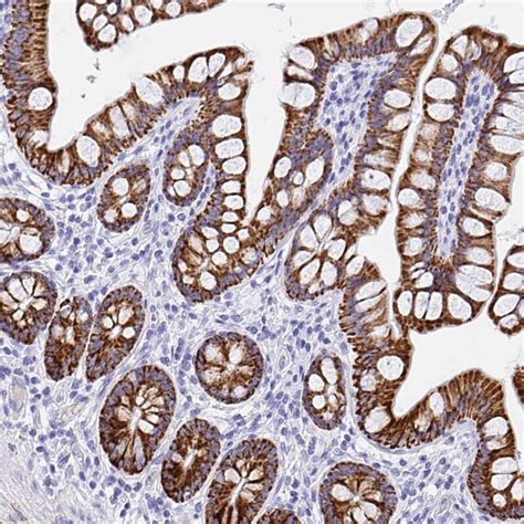 MAOA Antibody (PA5-63700)