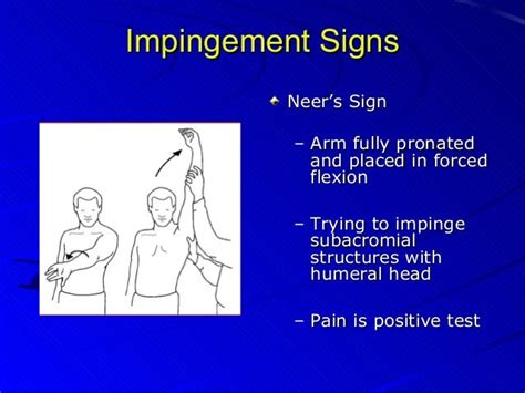 Shoulder exam studentsandresidents