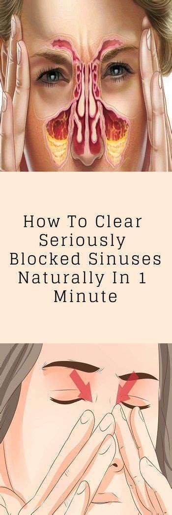 How To Clear Seriously Blocked Sinuses Naturally | Blocked sinuses, Sinusitis, Oils for sinus