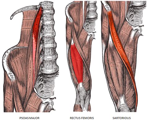 Hip Flexor Pain Treatments: Bronx, Brooklyn, Flatbush, Marine Park, NY