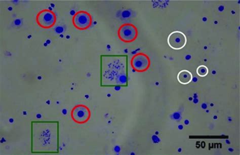 Metaphase Microscope