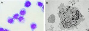 Natural Killer Cell - microbewiki