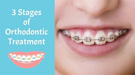 The 3 Stages of Orthodontic Treatment - YouTube