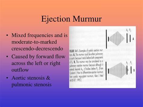 PPT - Systolic Ejection Murmurs Chapter 14 PowerPoint Presentation ...