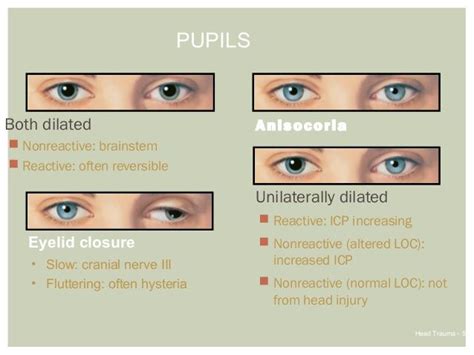 Pin by Lincy M on PA | Icu nursing, Picu nurse, Nursing mnemonics