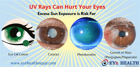 What Are The Ultraviolet Rays? Beneficial And Harmful Effects Of UV ...