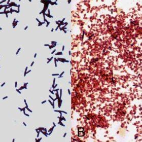 Bacillus Stearothermophilus Gram Stain