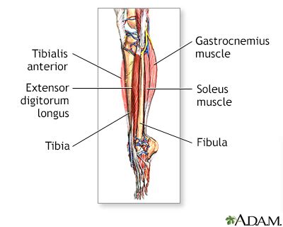 Leg pain Information | Mount Sinai - New York