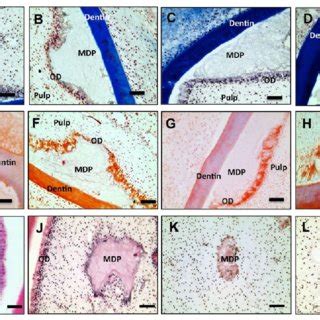 Hematoxylin and eosin (H&E) histology of odontoblast (OD) layer... | Download Scientific Diagram