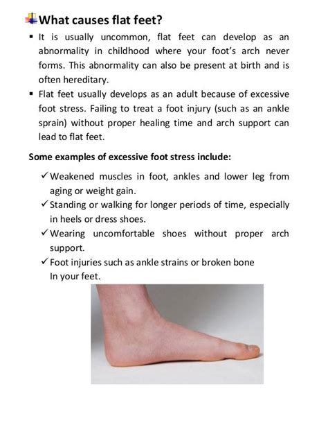 Flat feet – causes – symptoms – treatment