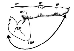 Trauma: Chronic Volkmann’s Contracture (48232) – CSC Staff Teaching and ...