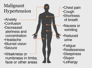 Hypertension Treatment Guidelines: Malignant Hypertension Symptoms ...