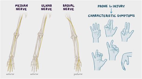 Correlaciones clínicas de anatomía: Nervios mediano, cubital y radial | Osmosis