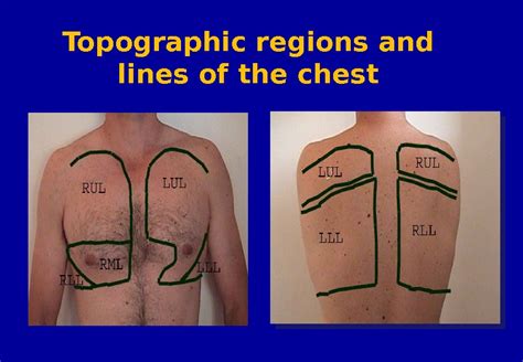 Percussion of the lungs Palpation of the chest