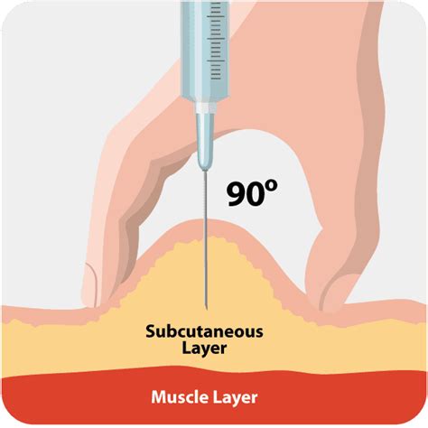 Insulin Injection Technique For Diabetes Depending On