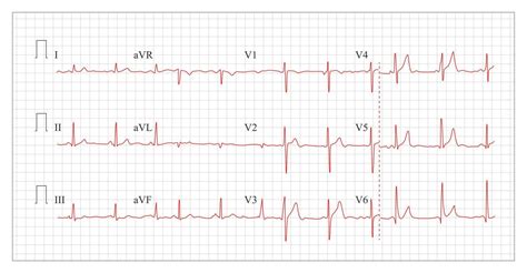 Heart Cardiogram Chart Vector. 19469954 Vector Art at Vecteezy