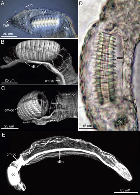 Sciency Thoughts: A new species of Gastrotrich from the Atlantic coast ...