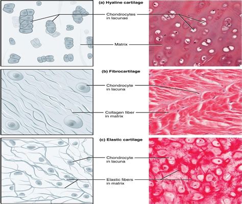 In humans, fibrous cartilage is found abundantly in(A) Hyaline ...