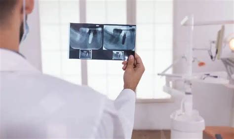 Advantages Of Intraoral Camera