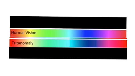 Is tritanomaly supposed to be VERY similar to normal vision? : r/ColorBlind