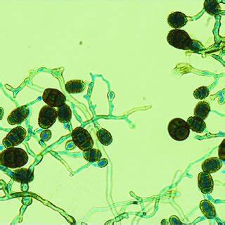 Macroscopic appearance of Pithomyces chartarum on Sabouraud Dextrose ...