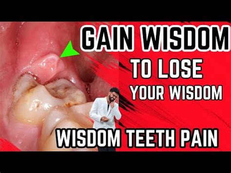 How To Relieve Wisdom Tooth Pain In Jaw / What S Causing My Jaw Pain ...