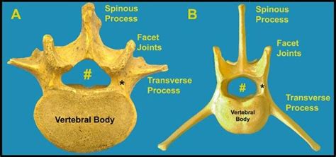 Comparative Image of human lumbar vertebrae (A) and canine lumbar... | Download Scientific Diagram