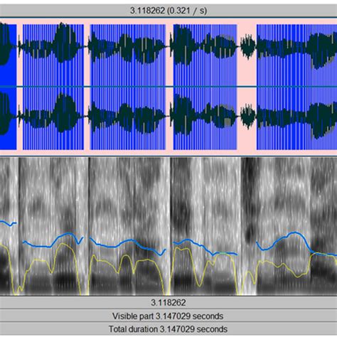 Voice Signal Waveform and Analysis | Download Scientific Diagram