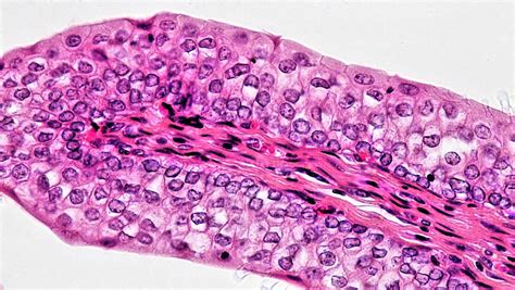 Epithelial Tissues: Transitional | cross section: urinary bl… | Flickr