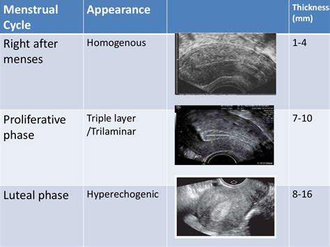 Basic gynae ultrasound