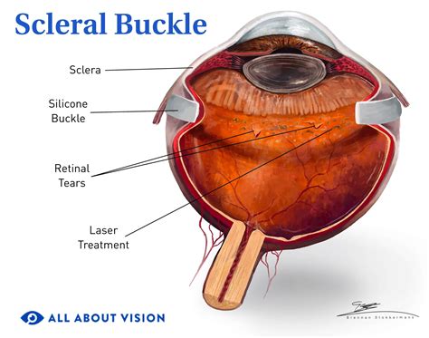 File:Human Eye Cross Section Scleral Wikipedia, 52% OFF