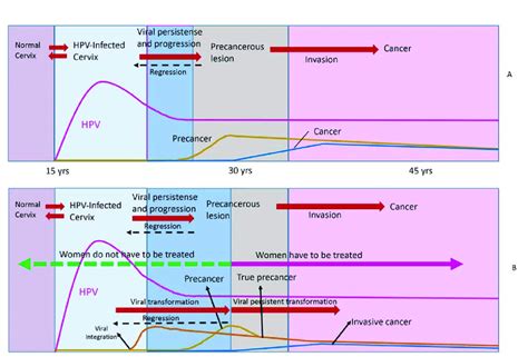 A) Natural history of HPV infection, transformation and invasive ...