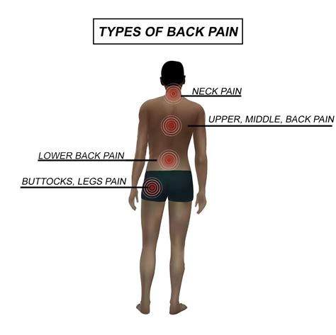 Back Pain Center: Upper, Mid & Lower Back - El Paso's Personal Injury ...