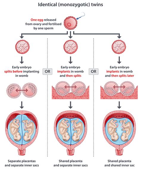 Twins- Types, Causes and Significance