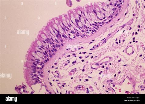 Epithelial tissue of trachea Tracheal epithelium Stock Photo - Alamy