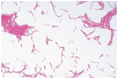 Microscope Slide w.m Pseudomonas aeruginosa Microscope Sample Slides ...