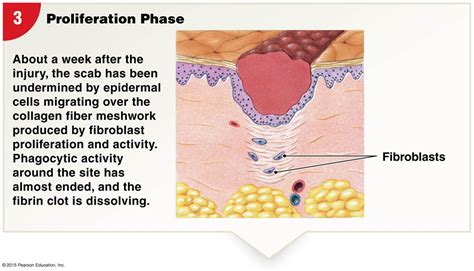 Proliferation Phase | Pearson education, Collagen fibers, Collagen